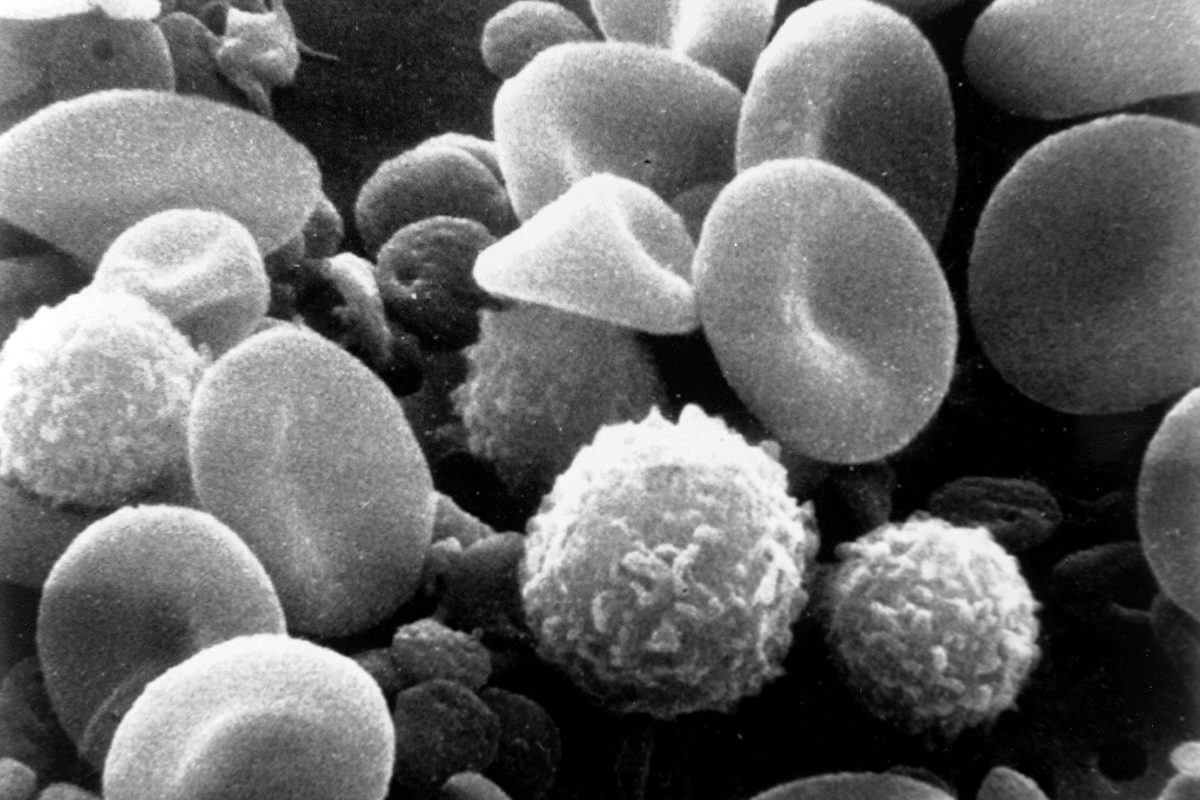 Black-and-white electron microscope picture of red blood cells, round white blood cells and small platelets