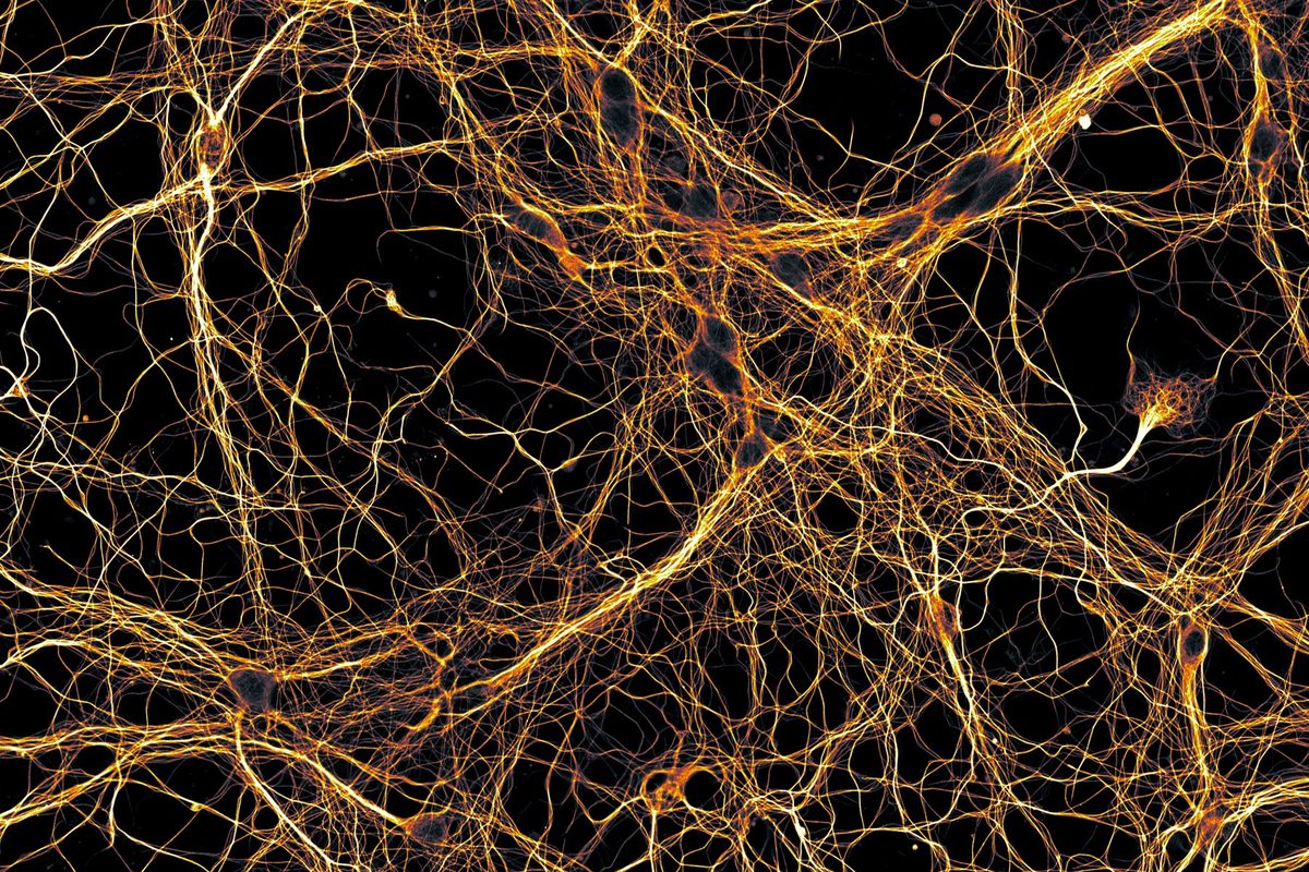 A dense web of golden nerve fibres on a black background, seen under a laser microscope