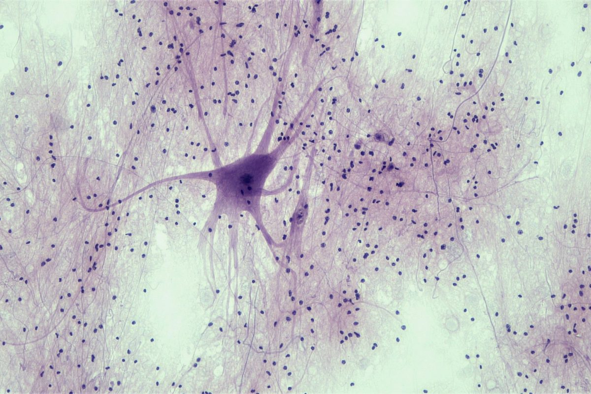 A large purple nerve cell with long branches among many small dark dots, seen under a microscope