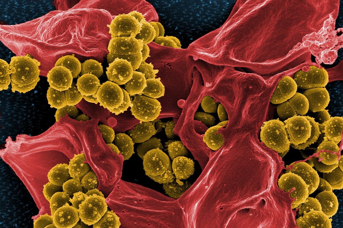 Clusters of round yellow bacteria on the folds of a red human white blood cell, seen under an electron microscope