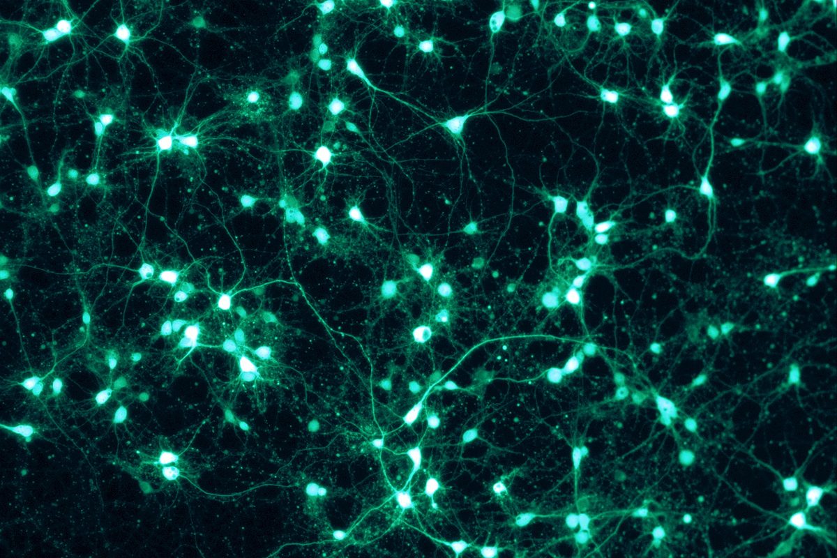 Glowing rat nerve cells joined by fine threads on a dark background, seen through a fluorescence microscope