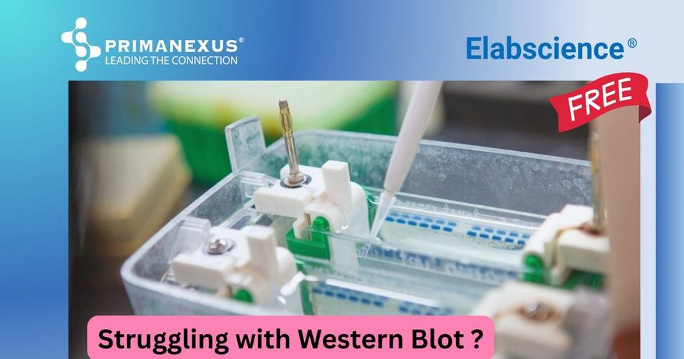 Poster for the free webinar Learn How Western Blot Detection Kits Improve Efficiency on 13 March 2025, with the Prima Nexus and Elabscience logos and a photo of the speaker, Dr Ramya Dewi